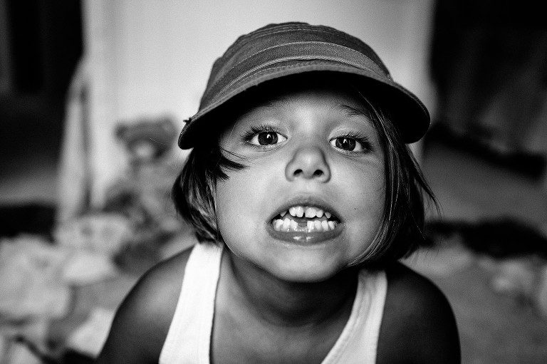 Black and white. 5 year old girl shows off where she lost her bottom center tooth. 