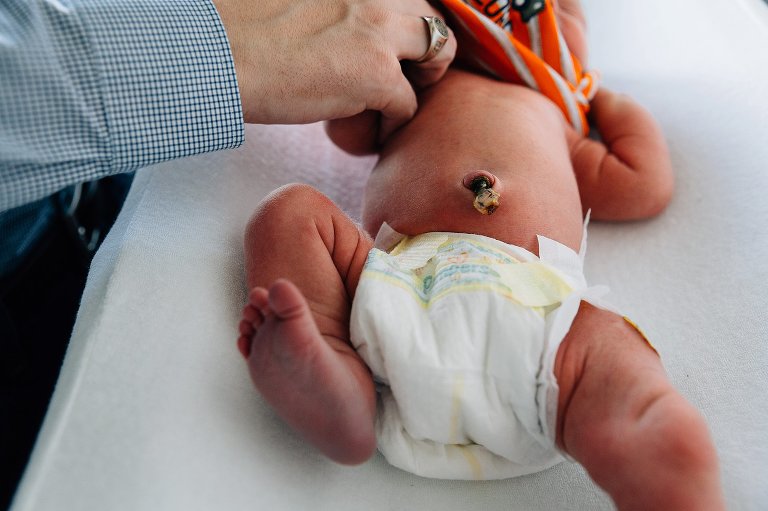 Dad pulling orange onesie over newborn's head. Attached umbilical cord on belly button is focus. 