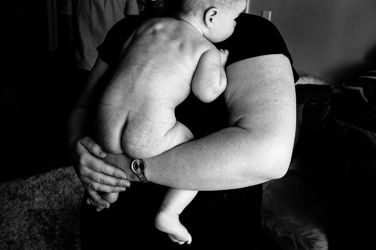 Black and white. Mother holds infant with wrinkled skin from clothing. 