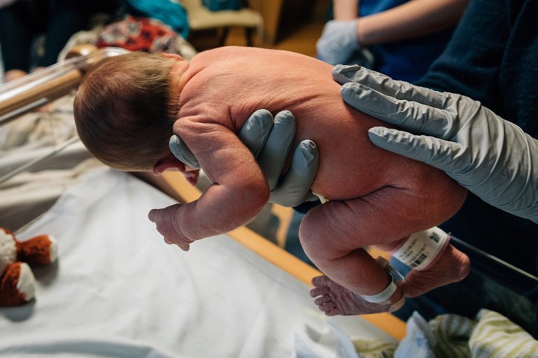 Doctor checks spine of newborn at the hospital. 